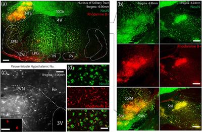 Systemic Sympathoexcitation Was Associated with Paraventricular Hypothalamic Phosphorylation of Synaptic CaMKIIα and MAPK/ErK